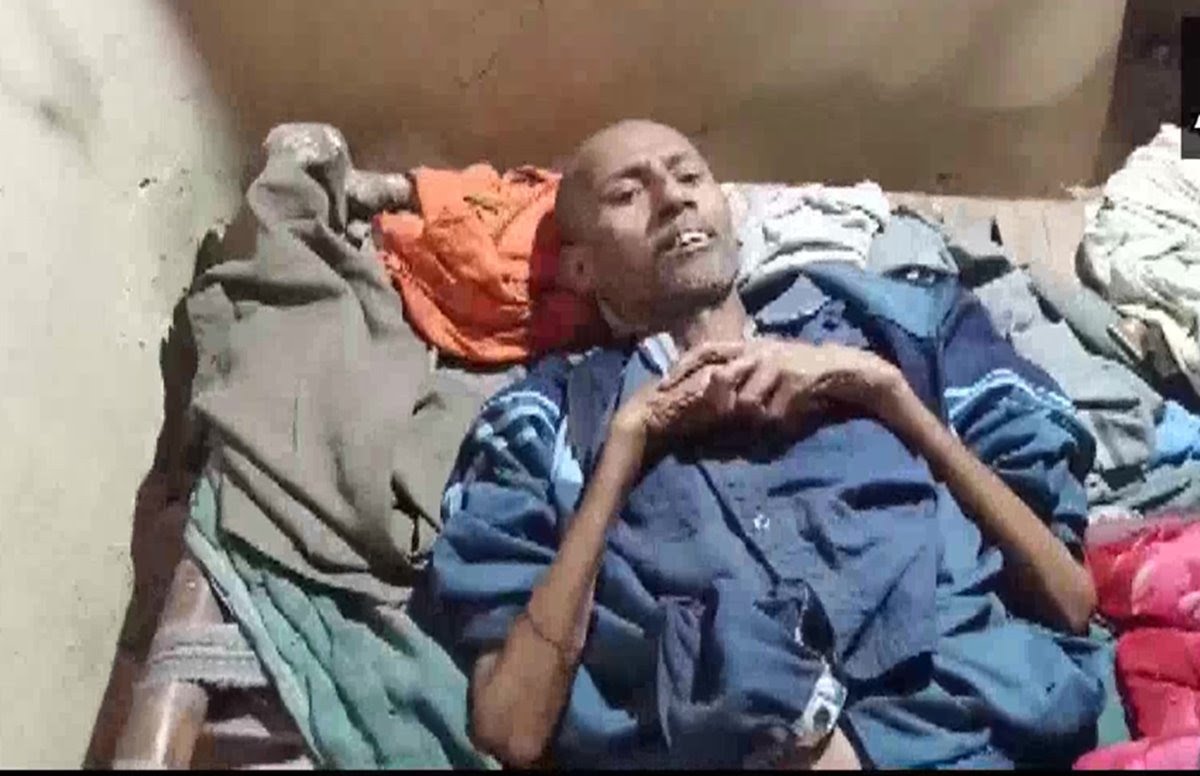 TB Patient starving for last 6 days (Photo: ANI/Twitter)