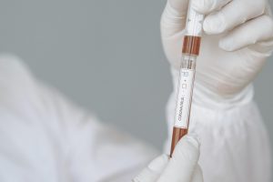 Coronavirus test pexels-gustavo-fring-4149042