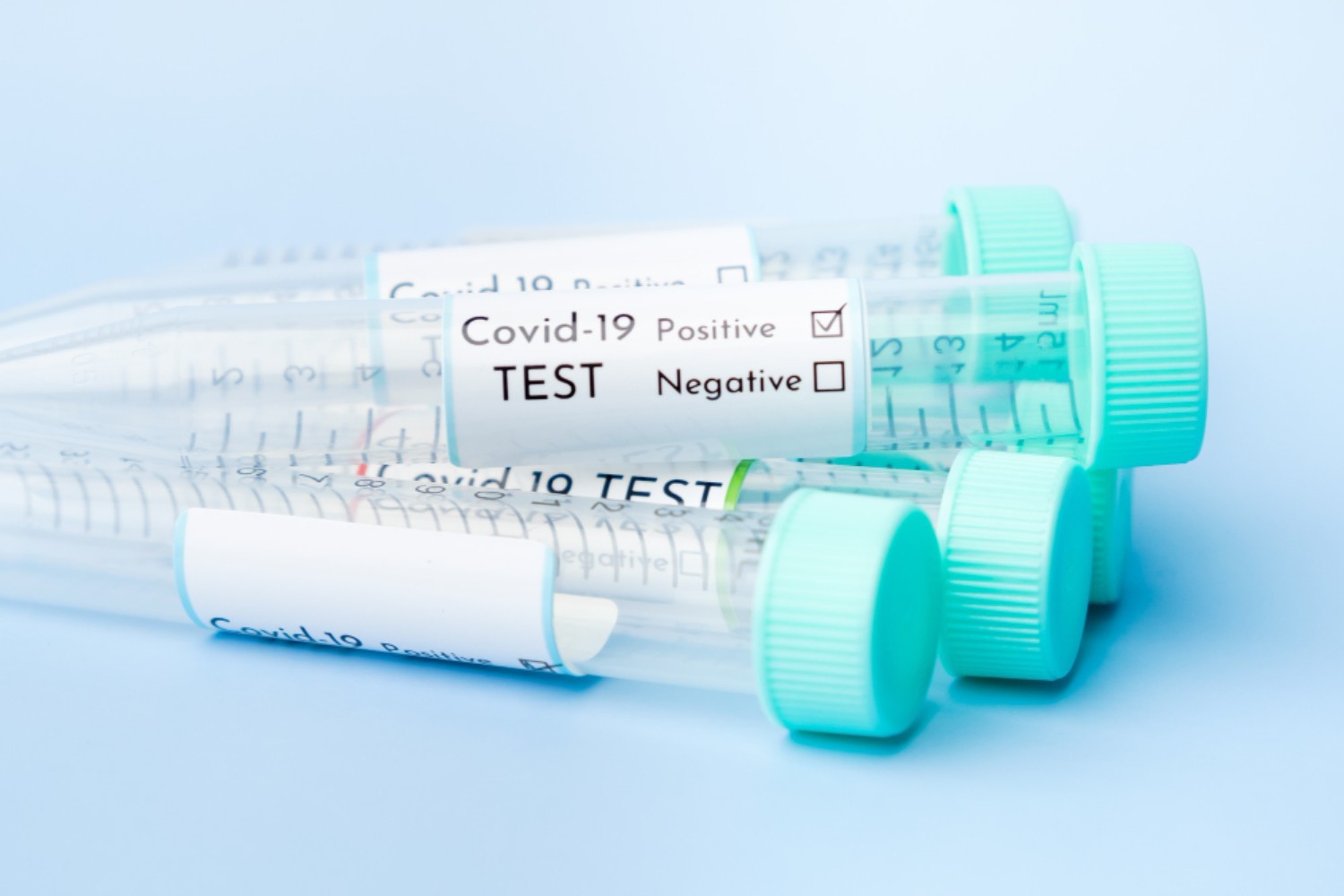 COVID test-tubes-coronavirus-covis-19-samples-with-positive-results (1)