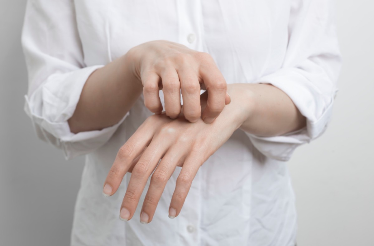 Itching woman-scratches-her-hand (1)