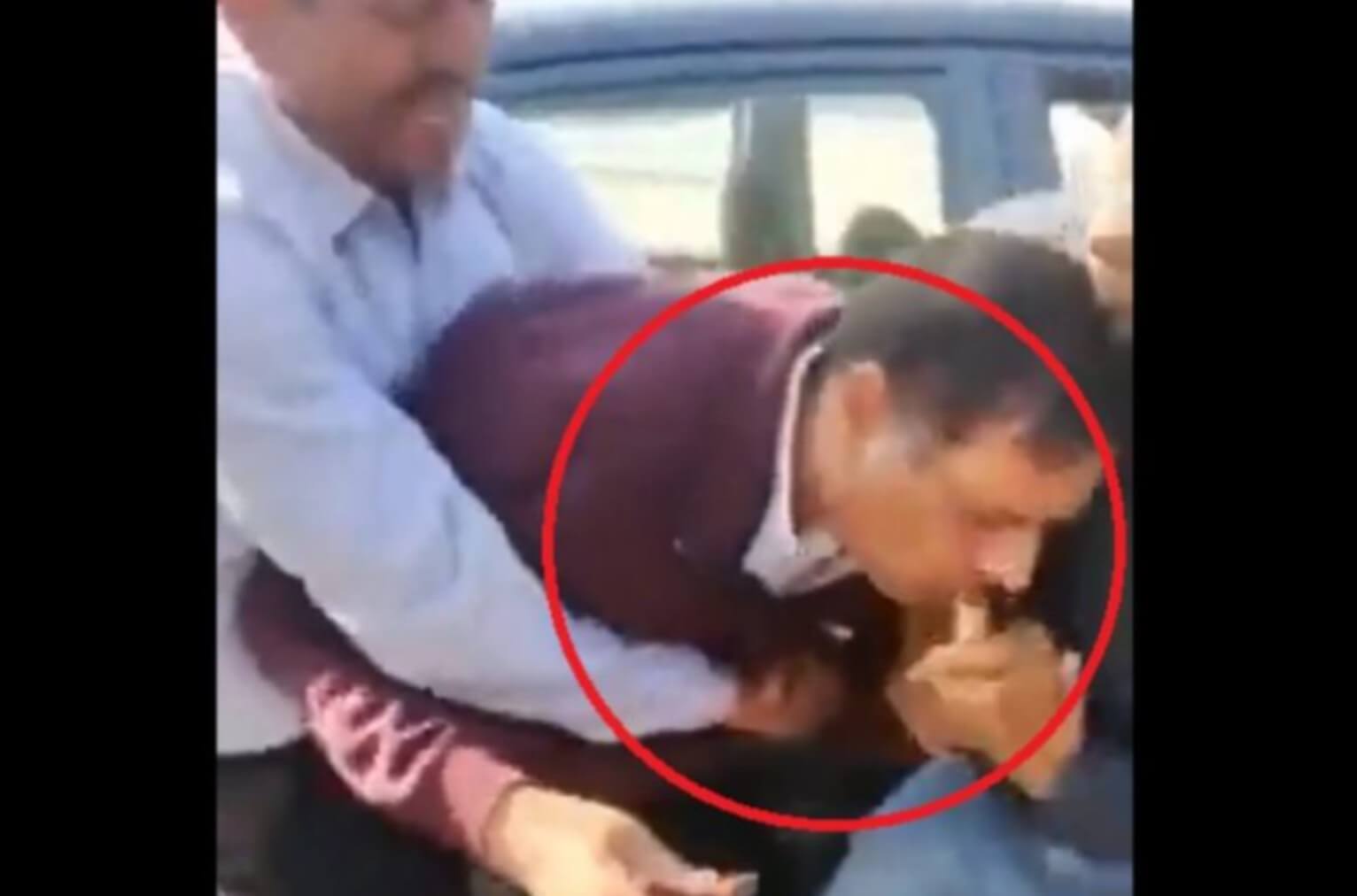 Man swallows currency notes Faridabad (1)