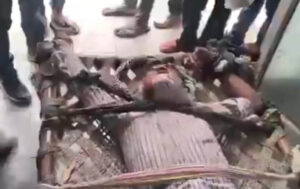 Aligarh News Dog Bite (1)